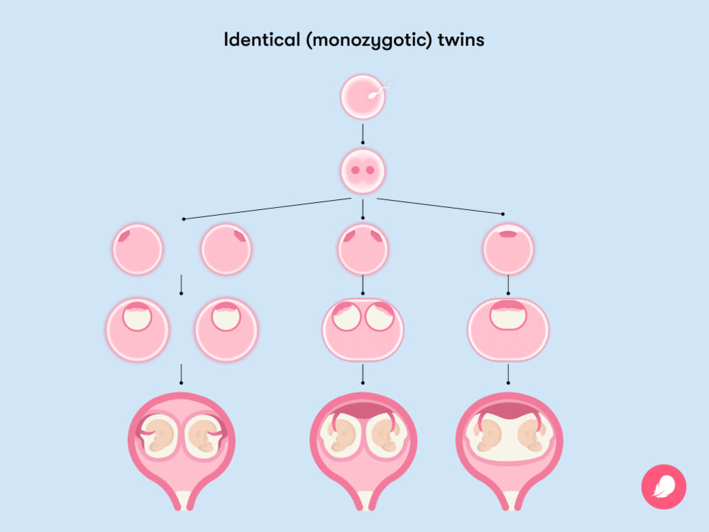 How To Get Pregnant With Twins Everything You Need To Know About Twin